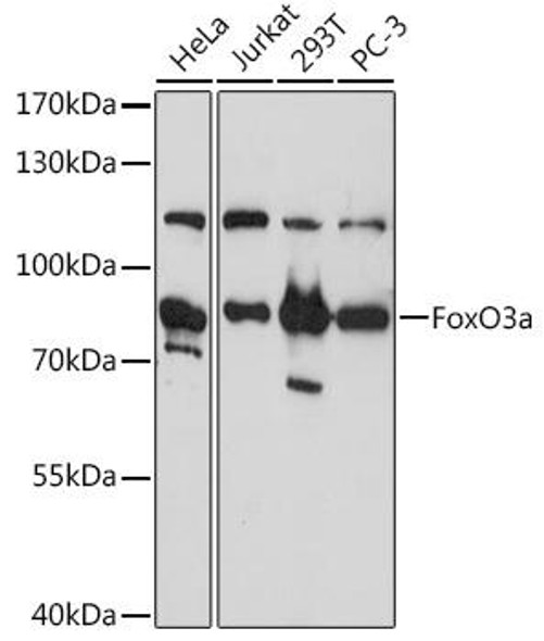 Anti-FoxO3a Antibody (CAB0102)