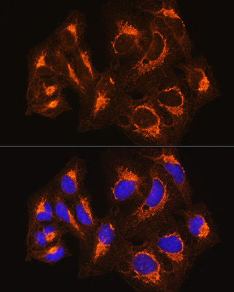 Anti-Bak Antibody (CAB0204)