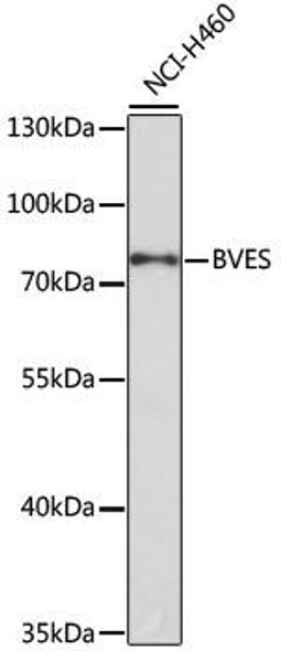 Anti-BVES Antibody (CAB0213)