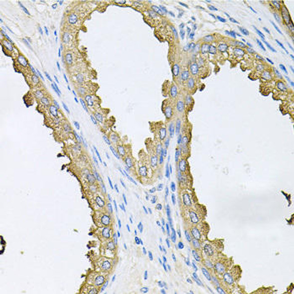 Anti-ABL1 Antibody (CAB0282)