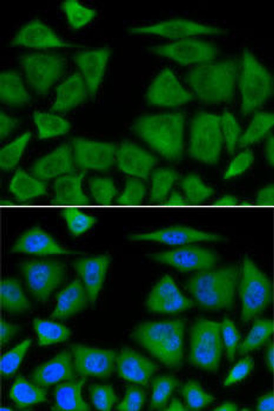 Anti-BIM Antibody (CAB0295)