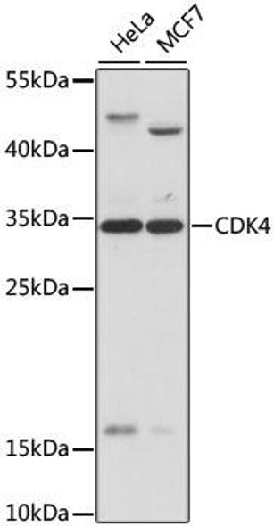 Anti-CDK4 Antibody (CAB0366)