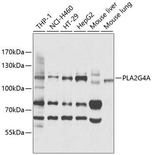 Anti-PLA2G4A Antibody (CAB0394)