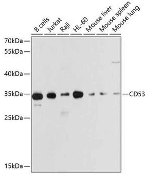 Anti-CD53 Antibody (CAB10079)