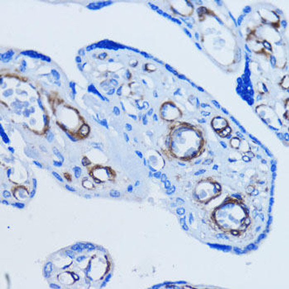 Anti-alpha smooth muscle actin Antibody (CAB1011)