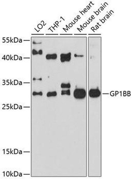 Anti-GP1BB Antibody (CAB10113)
