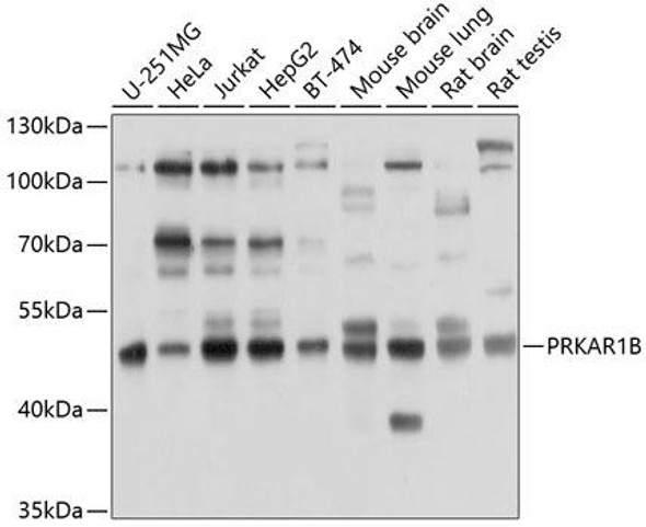 Anti-PRKAR1B Antibody (CAB10125)