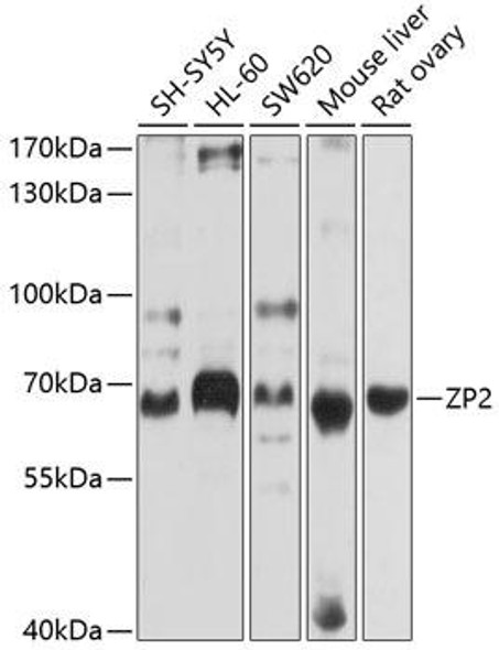 Anti-ZP2 Antibody (CAB10126)