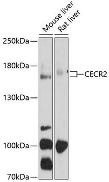 Anti-CECR2 Antibody (CAB10143)