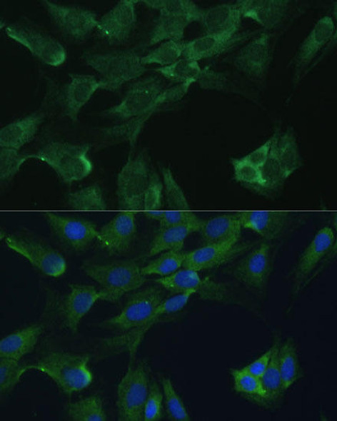 Anti-ADA Antibody (CAB1019)