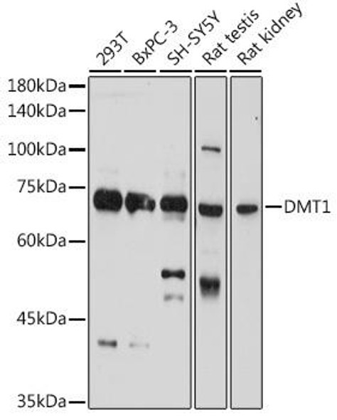 Anti-DMT1 Antibody (CAB10231)