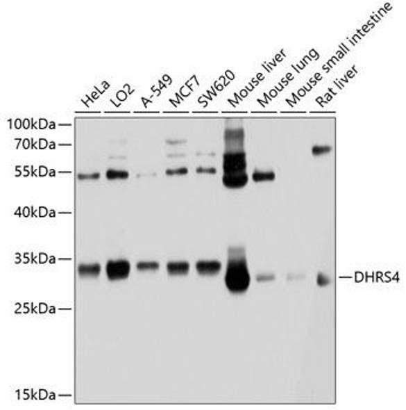 Anti-DHRS4 Antibody (CAB10285)