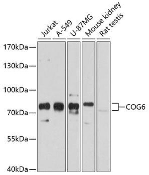 Anti-COG6 Antibody (CAB10319)