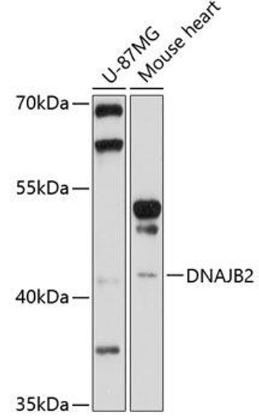 Anti-DNAJB2 Antibody (CAB10345)