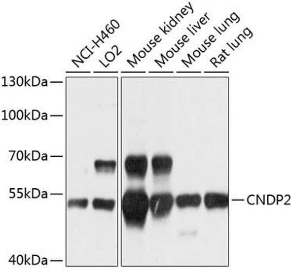 Anti-CNDP2 Antibody (CAB10381)