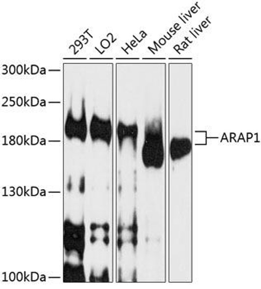 Anti-ARAP1 Antibody (CAB10466)