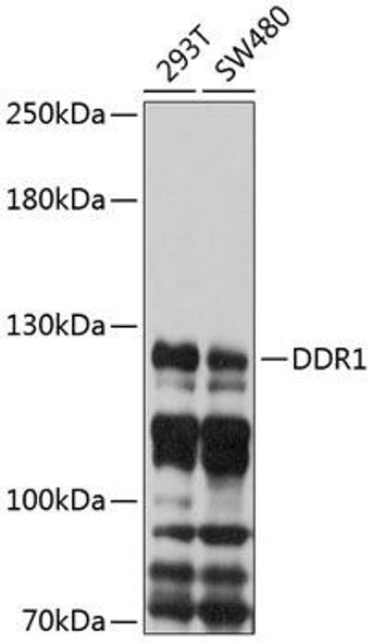 Anti-DDR1 Antibody (CAB10487)