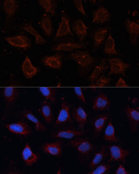 Anti-ANO1 Antibody (CAB10498)