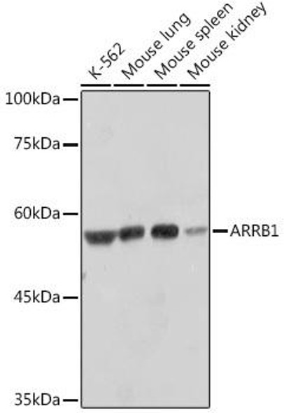 Anti-ARRB1 Antibody (CAB10742)