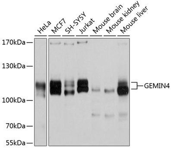 Anti-GEMIN4 Antibody (CAB10764)