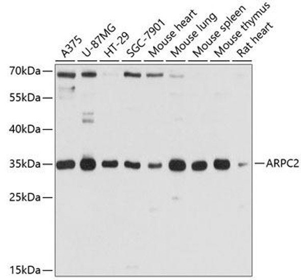 Anti-ARPC2 Antibody (CAB10791)