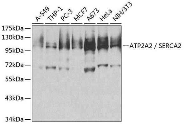 Anti-ATP2A2 / SERCA2 Antibody (CAB1097)