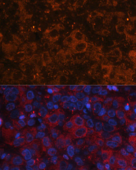 Anti-AFP Antibody (CAB11013)