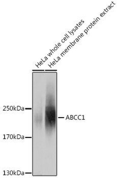 Anti-ABCC1 Antibody (CAB11153)