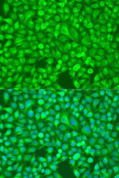 Anti-NF-kB2 Antibody (CAB11163)