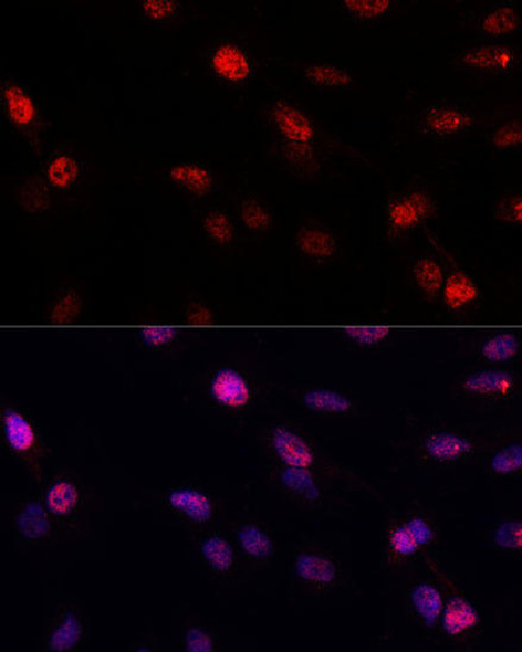 Anti-BRCA1 Antibody (CAB11318)