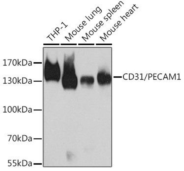 Anti-CD31/PECAM1 Antibody (CAB11525)