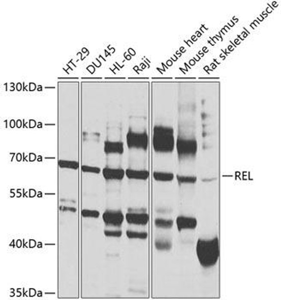 Anti-REL Antibody (CAB1181) Anti-REL Antibody (CAB1181)
