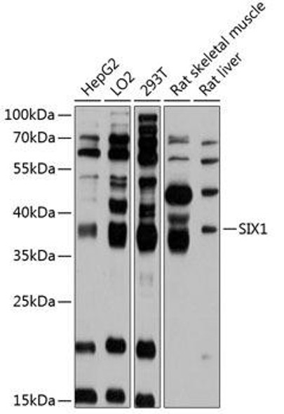 Anti-SIX1 Antibody (CAB11954)