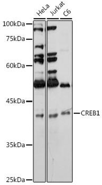 Anti-CREB1 Antibody (CAB11989)