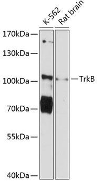 Anti-TrkB Antibody (CAB12011)