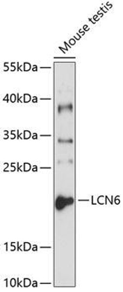 Anti-LCN6 Antibody (CAB1204)