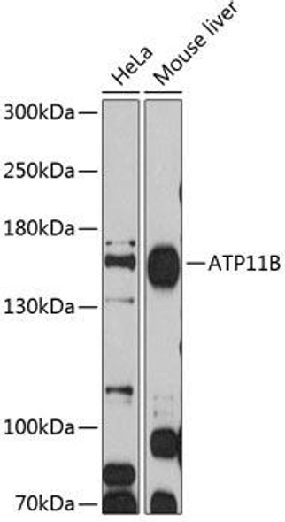 Anti-ATP11B Antibody (CAB12203)