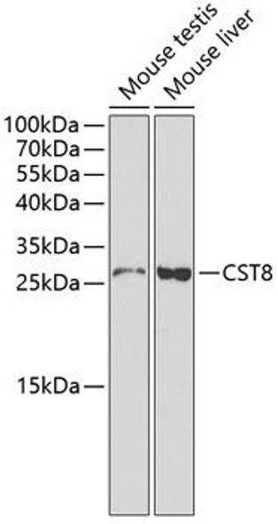 Anti-CST8 Antibody (CAB1224)