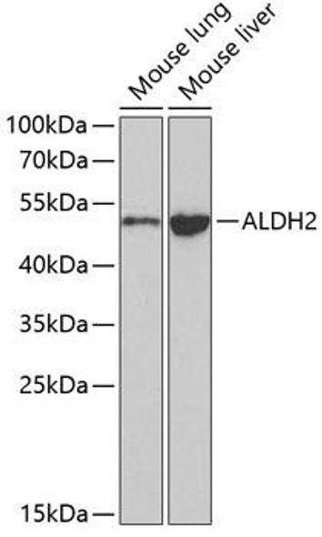 Anti-ALDH2 Antibody (CAB1226)