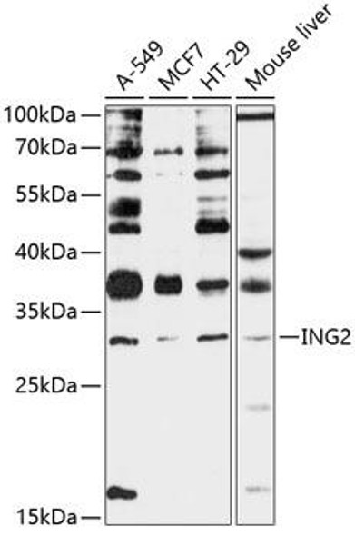 Anti-ING2 Antibody (CAB12266)
