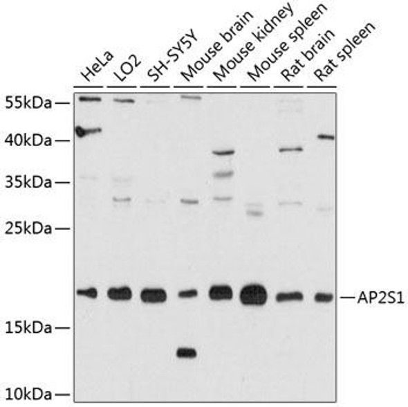 Anti-AP2S1 Antibody (CAB12270)