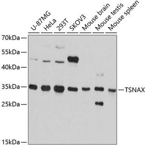 Anti-TSNAX Antibody (CAB12276)