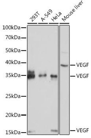 Anti-VEGF Antibody (CAB12303)