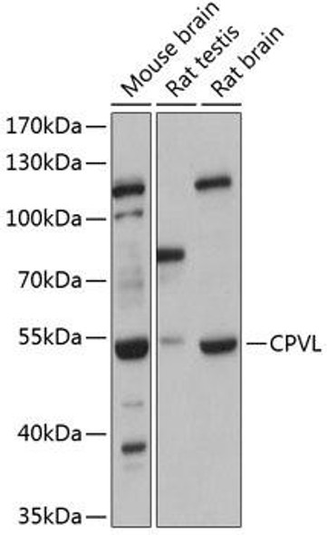 Anti-CPVL Antibody (CAB12369)