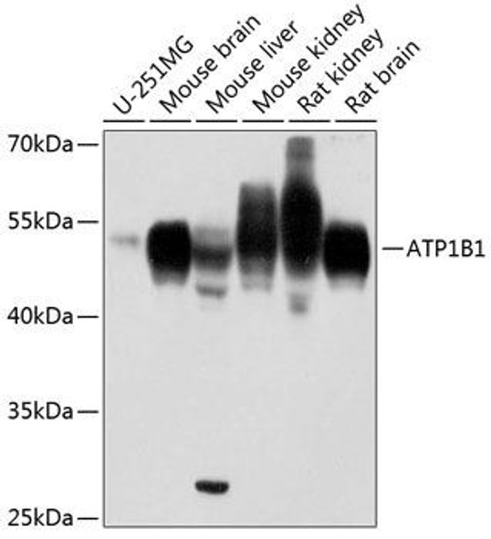 Anti-ATP1B1 Antibody (CAB12403)