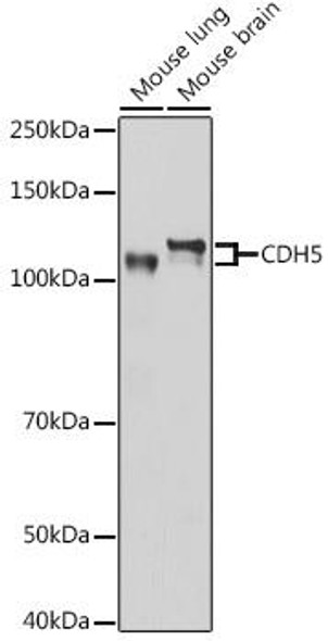 Anti-CDH5 Antibody (CAB12416)