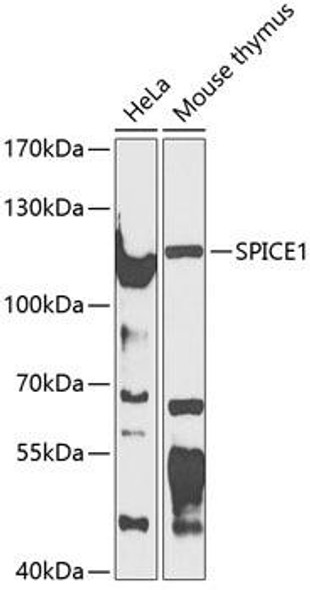 Anti-CCDC52 Antibody (CAB12611)