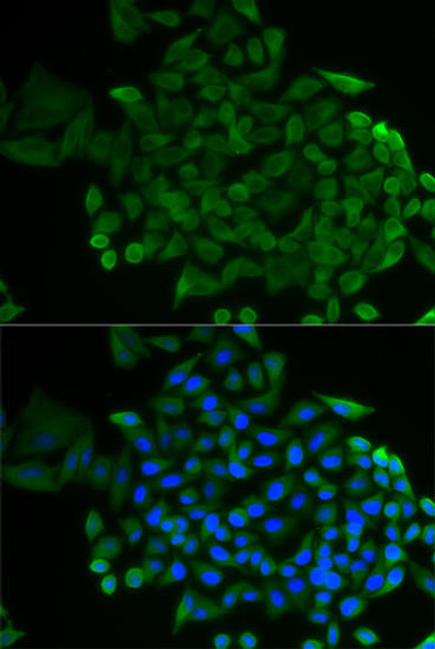 Anti-COG2 Antibody (CAB12626)