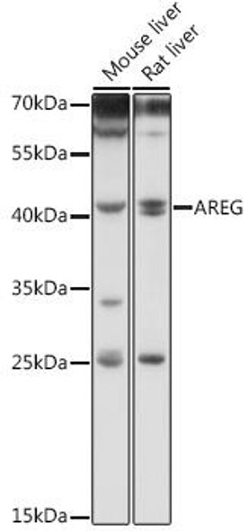 Anti-AREG Antibody (CAB12680)