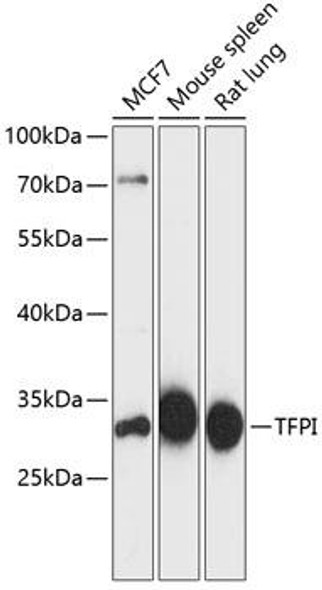 Anti-TFPI Antibody (CAB12692)